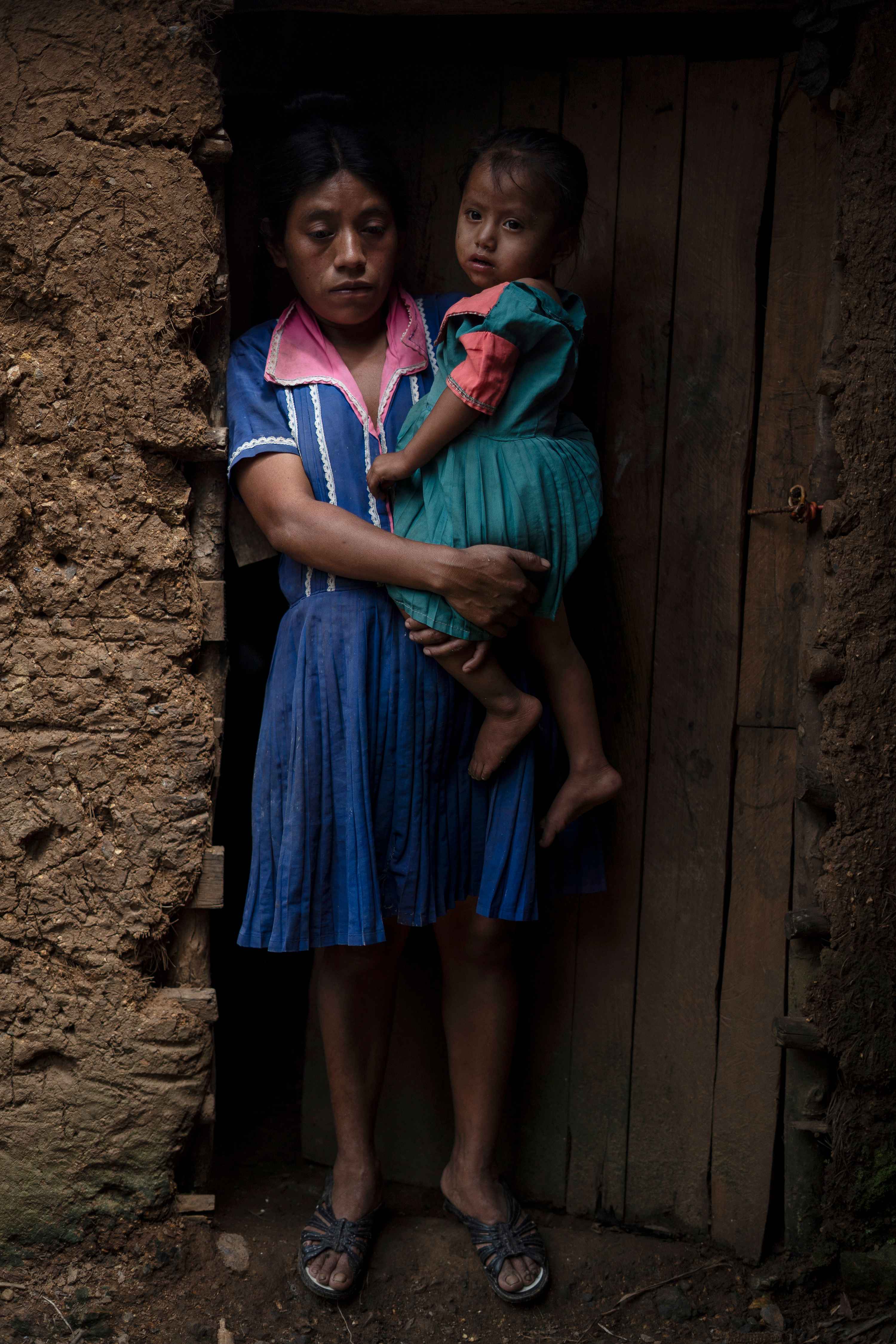 “I don’t remember anymore. After so many emotions piling up over the years, I’ve forgotten,” Saturnina says of the death of her youngest son, Nery. “It was on April 18,” yells her neighbor Juana, overhearing the conversation from a distance. Nery was born on Dec. 11, 2023, at the National Hospital in Chiquimula. At three months old, the child began to cough heavily and lose weight. Saturnina took him to the communal clinic in Palmilla, the nearest village. She walked for an hour with her baby in her arms. “They saw him, then told me that they’d come to my house in a week to check on him again, but he died before they could come,” she says. Saturnina says that her son died of ansia , a term that means “yearning” or “craving” in Spanish, used locally to describe various symptoms of child malnutrition that cause weight loss following an illness or starvation. Saturnina does not know how to read or write. She plants corn to feed her three other children. Sometimes her husband finds temporary work, earning Q50 (less than $7) per day.