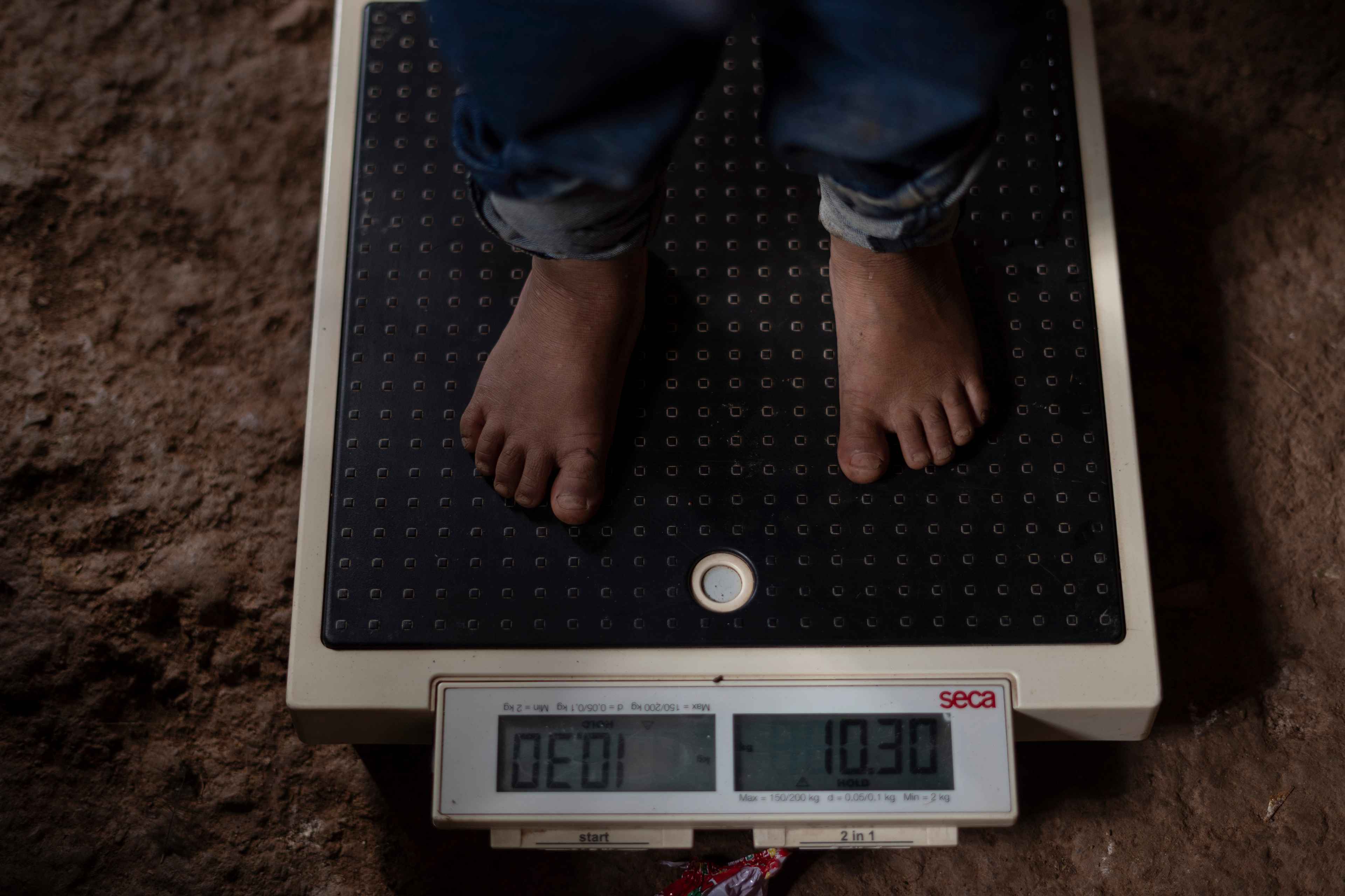About 600 people live in La Ceiba Talquezal. One hundred and fifty, or 25 percent of the total population, are children under the age of five. Health worker Israel Ramírez says that, since assuming his position in 2013, they have recorded the deaths of 18 children in the community. The three most recent deaths were in April 2024, according to figures from the community health commission, which attributed their deaths to anemia. The Ministry of Health and Action Against Hunger also recorded three deaths of children during the first months of the year, attributing two of the deaths to dehydration and prolonged diarrhea without medical attention, and one to respiratory problems. In August 2024, Action Against Hunger conducted a nutritional study of 91 children in the community. The data are worrying: 78 percent of the children were chronically malnourished and ten children were at risk of acute malnutrition.